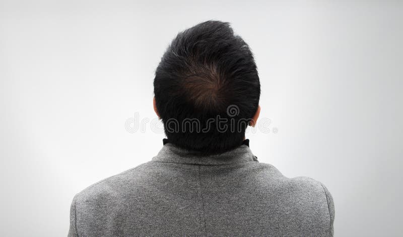 Doctor Inject Treatment Serum Vitamins Hair Fall Stock Photo - Image of  hand, cure: 138163928
