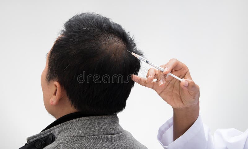 Doctor Inject Treatment Serum Vitamins Hair Fall Stock Photo - Image of closeup, damaged: 138164024 Doctor Inject Treatment Serum Vitamins Hair Fall Stock Photo - Image of closeup, damaged: 138164024
