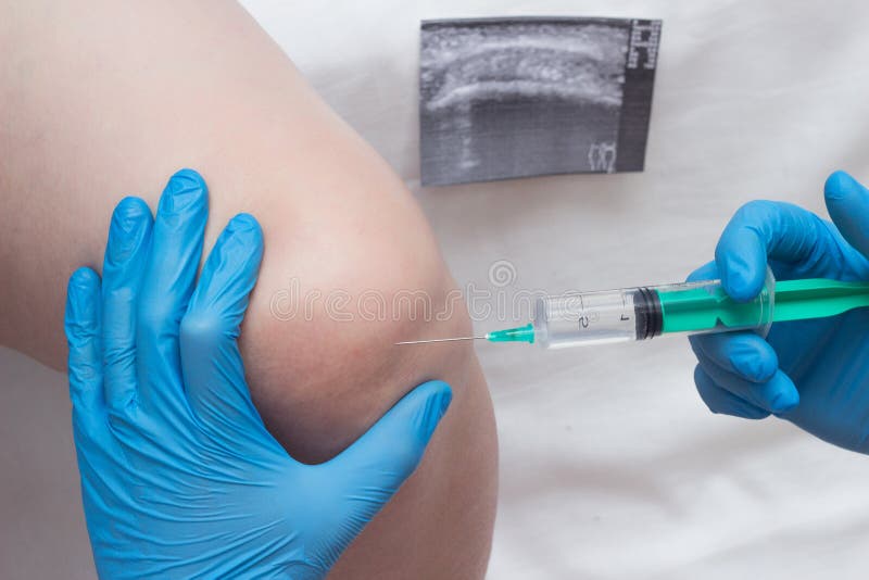 A doctor injects a medical injection of chondroprotector and hyaluronic acid into the knee of a woman to restore the knee joint royalty free stock image A doctor injects a medical injection of chondroprotector and hyaluronic acid into the knee of a woman to restore the knee joint royalty free stock image