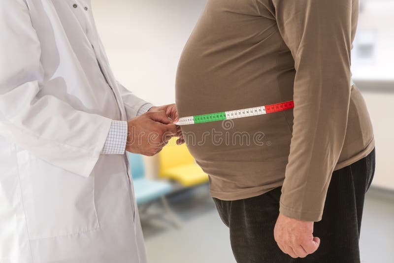 Doctor measuring obese man waist body fat. Obesity and weight loss.