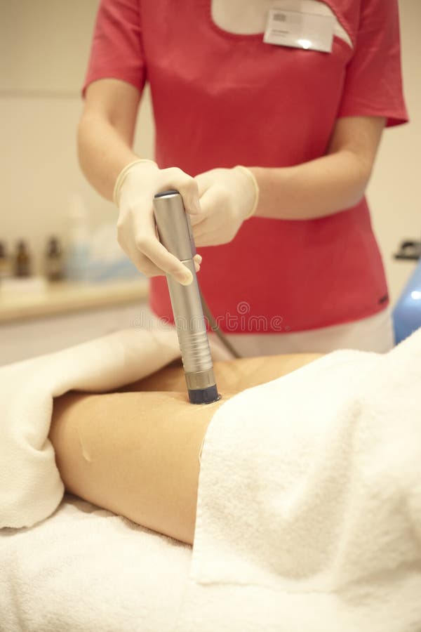 Doctor on a medical procedure - cellulite theraphy