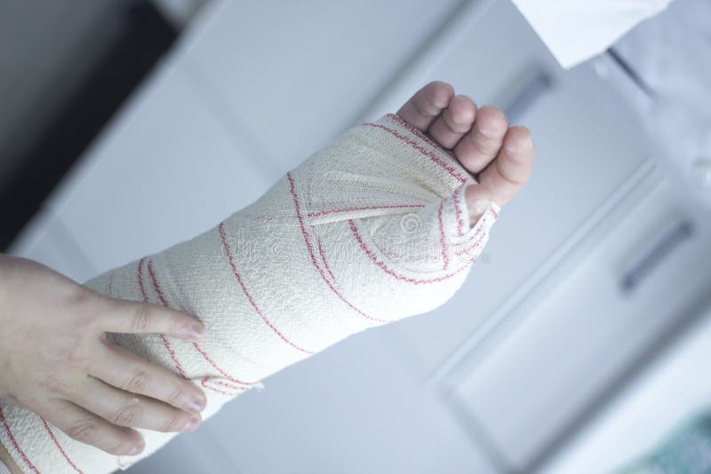 Doctor Patient Plaster Cast Stock Image - Image of medical, injury ...