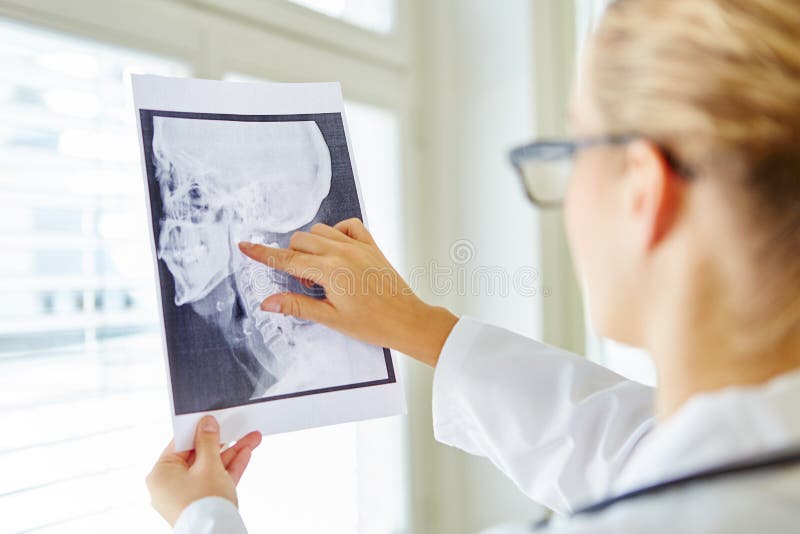 Doctor que analiza imagen de la radiografía