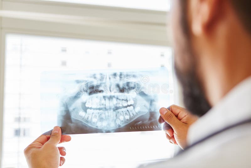 Doctor que lleva a cabo imagen de la radiografía del mandíbula
