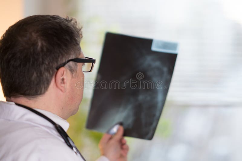 Doctor Reading Xray Images Stock Image Image of paramedic, medic