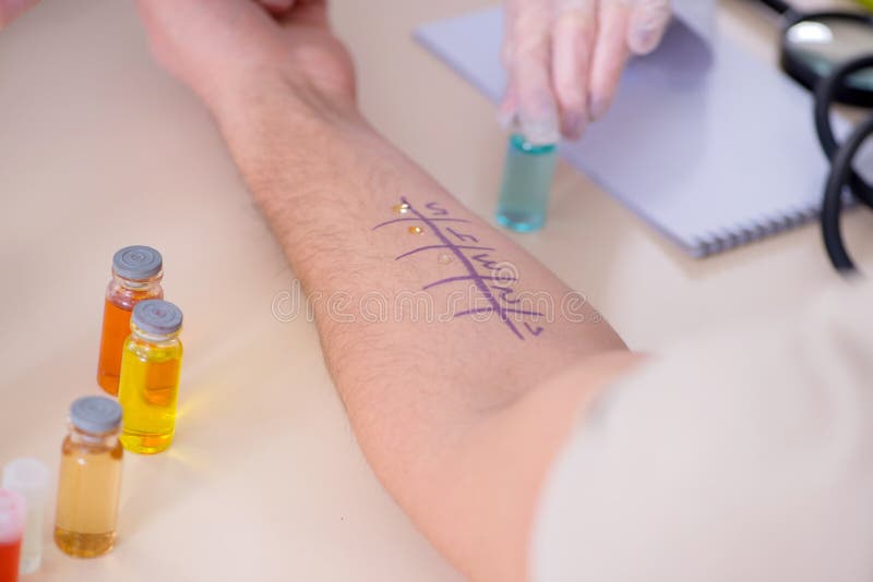 The Doctor Testing Allergy Reaction of Patient in Hospital Stock Photo