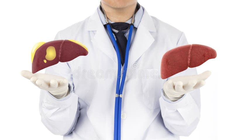 Doctor touch fatty on liver
