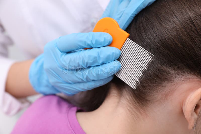 Doctor Using Nit Comb on Little Girl`s Hair Indoors. Anti Lice Treatment  Stock Photo - Image of contagious, gloves: 213338020