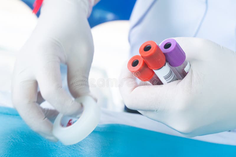 Doctors are Collecting Blood Samples from Patients for Examination