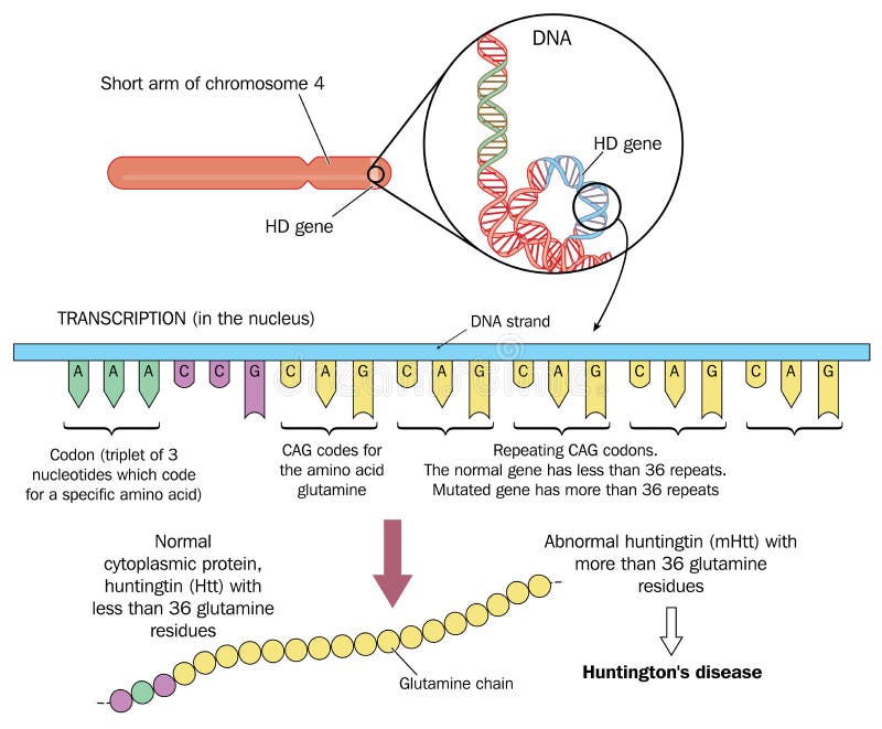 A doença de Huntington ilustração do vetor. Ilustração de discurso