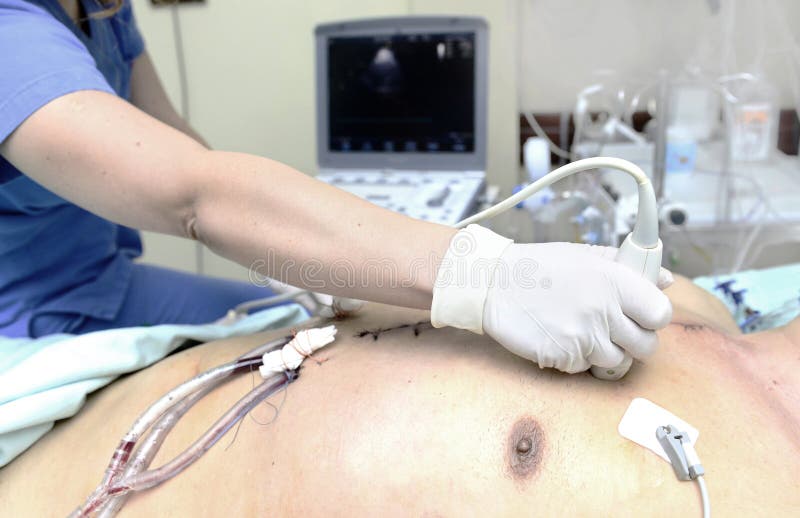 Doktor führt echokardiographische Prüfung durch lizenzfreies stockfoto Doktor führt echokardiographische Prüfung durch lizenzfreies stockfoto