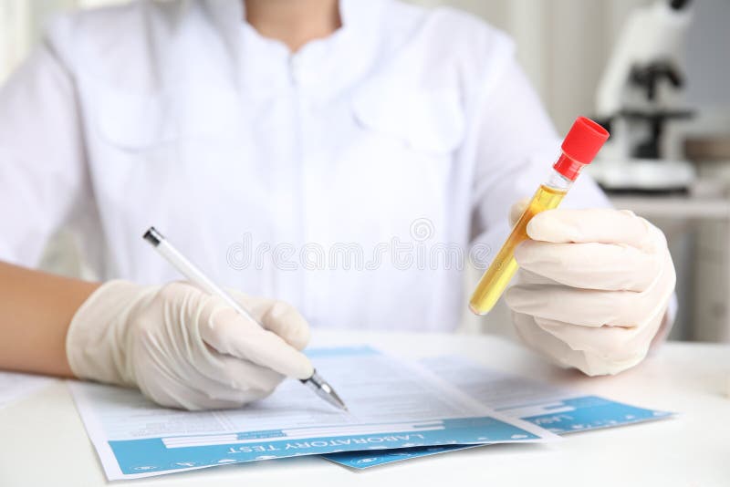 Doctor holding test tube with urine sample for analysis at table in laboratory, closeup. Doctor holding test tube with urine sample for analysis at table in laboratory, closeup