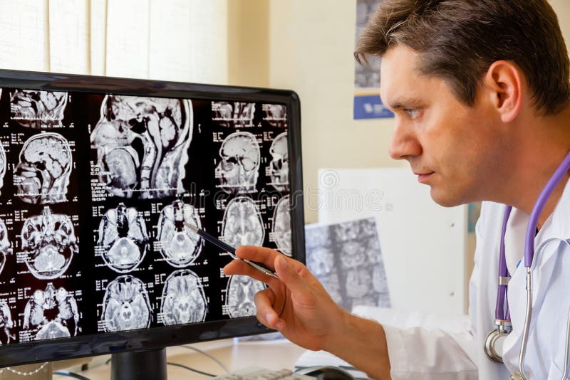 Doktorski egzamininujący MRI obraz cyfrowego mózg