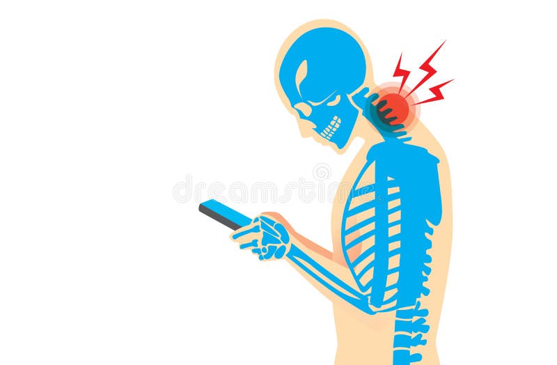 Dolor de cuello de Smartphone