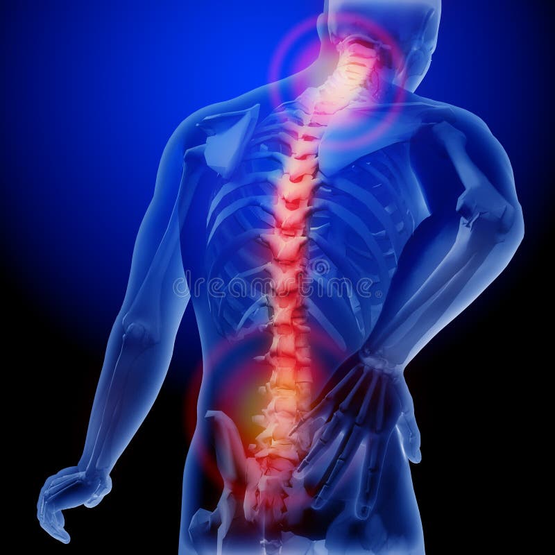 Dolor de la espina dorsal Radiografía del esqueleto y del cuerpo Cuerpo anatómico de un hombre ejemplo médico 3D