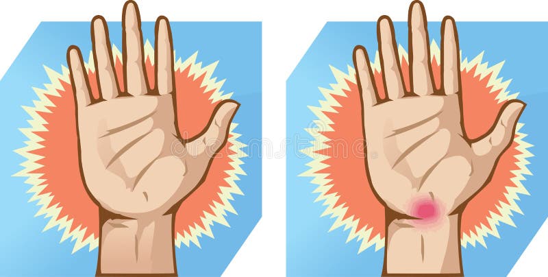 Dolor de la mano ilustración del vector. Ilustración de mano - 37573066
