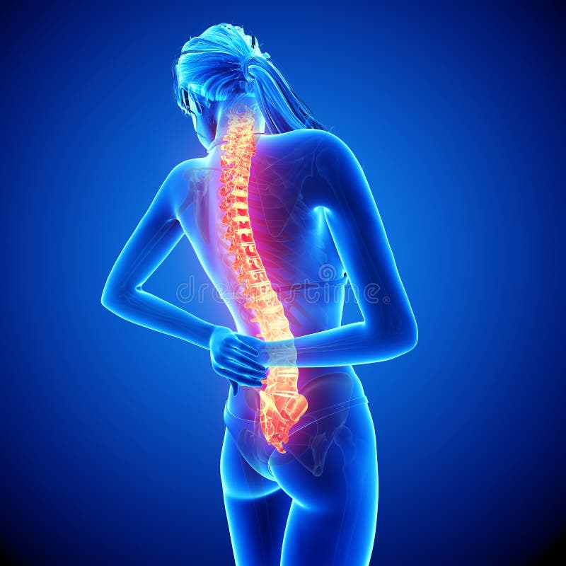Dolor femenino de la espina dorsal