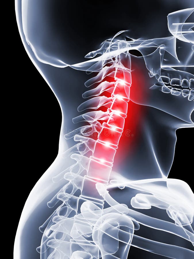 Dolore al collo illustrazione di stock.