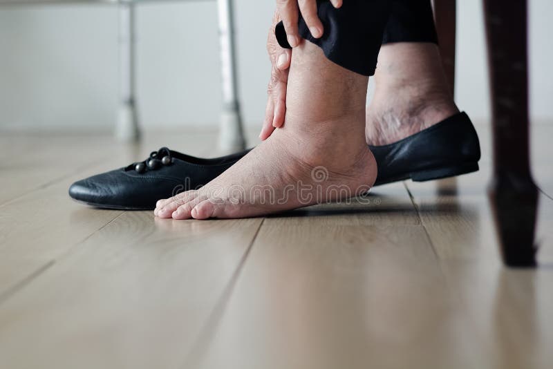 Donna anziana gonfiata piedi che mettono sulle scarpe fotografia stock Donna anziana gonfiata piedi che mettono sulle scarpe fotografia stock