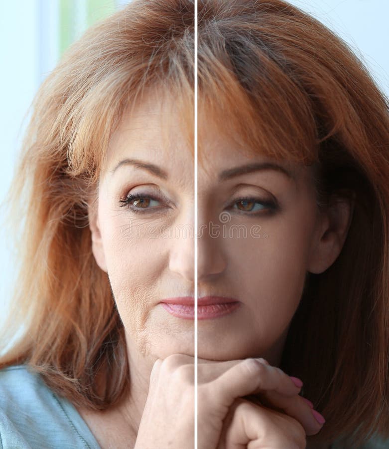 Donna matura prima e dopo l'operazione cosmetica su fondo vago fotografie stock libere da diritti Donna matura prima e dopo l'operazione cosmetica su fondo vago fotografie stock libere da diritti