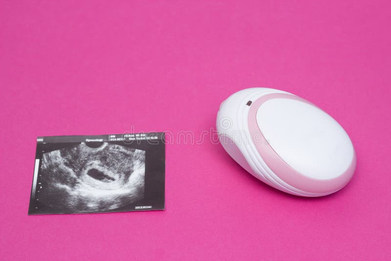 Doppler Foetal Pour écouter Dans Un Battement De Coeur De Femme Enceinte  D'un Enfant Et D'une Image D'un Ultrason De Grossesse, P Photo stock -  Image du coeur, maison: 132521458