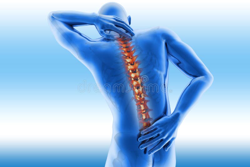 3D image spine pain - vertebrae trauma x-ray on a blue background. 3D image spine pain - vertebrae trauma x-ray on a blue background