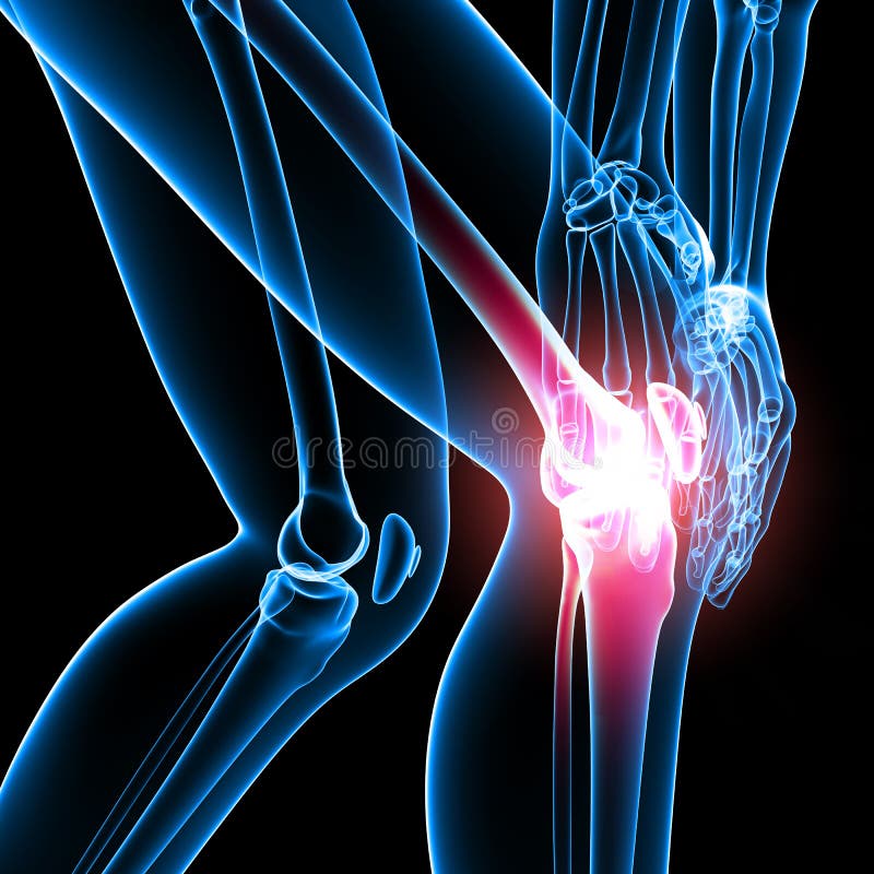 3d rendered medical x-ray illustration of transparent Knee pain of right leg skeleton. 3d rendered medical x-ray illustration of transparent Knee pain of right leg skeleton