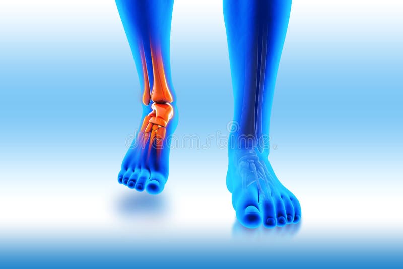 3D image ankle pain - hurt trauma on a blue background. 3D image ankle pain - hurt trauma on a blue background