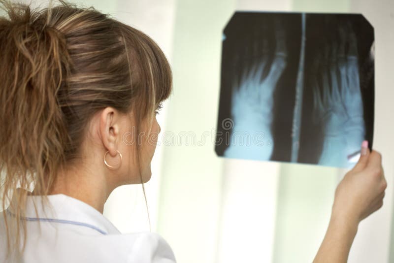 Female doctor looking at a lungs or torso xray. Female doctor looking at a lungs or torso xray