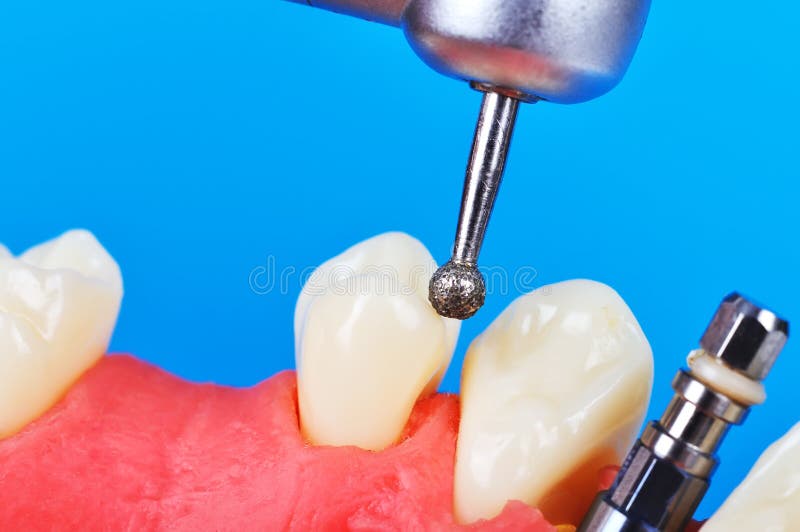 Drill and dental implant