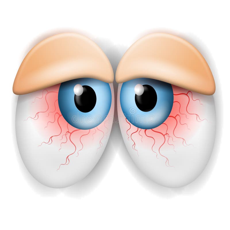 Download Droopy Tired Bloodshot Eyes Stock Illustration - Image ...