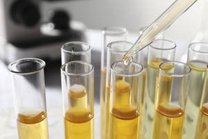 Dropping Urine Sample For Analysis Into Tube In Laboratory Closeup 