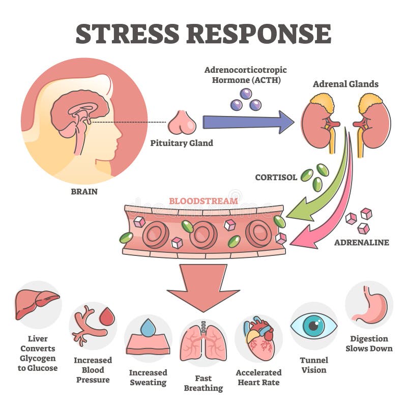 Stress response anatomical scheme with body inner reaction outline concept. Hormonal process with symptoms and description when ACTH, cortisol and adrenaline flows in bloodstream vector illustration. Stress response anatomical scheme with body inner reaction outline concept. Hormonal process with symptoms and description when ACTH, cortisol and adrenaline flows in bloodstream vector illustration.