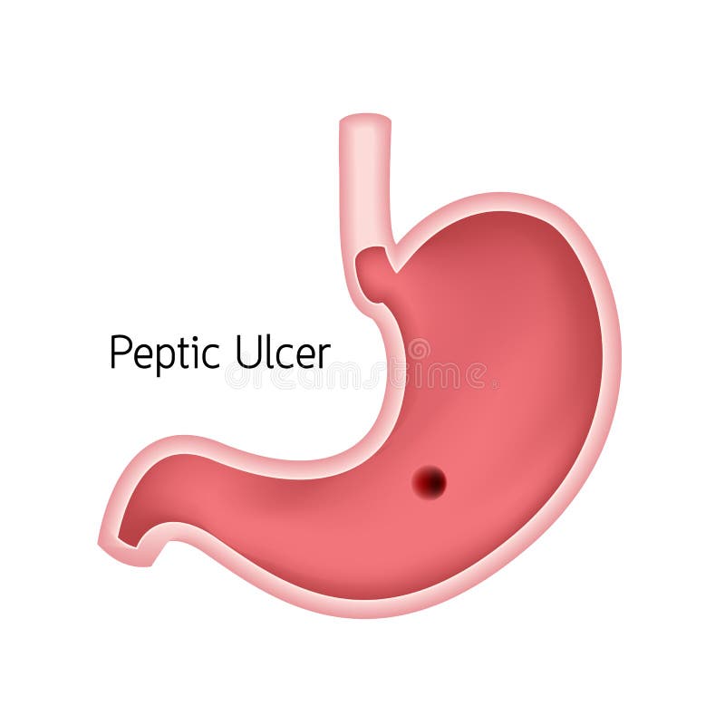 Dwarsdoorsnede van menselijke maag E vector illustratie