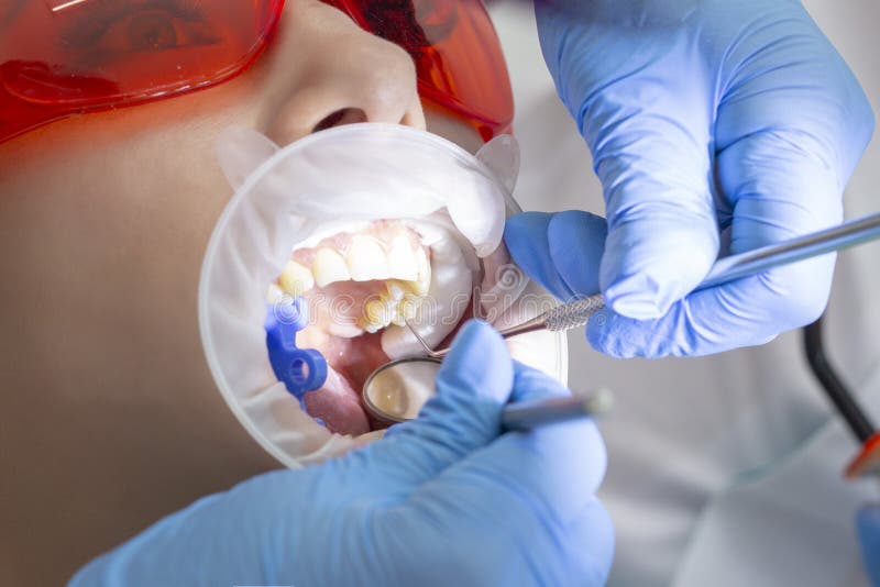 Dziewczyna na egzaminie przy dentysty traktowaniem próchnicowy ząb lekarka używa lustro na rękojeści i boron maszynie obrazy stock Dziewczyna na egzaminie przy dentysty traktowaniem próchnicowy ząb lekarka używa lustro na rękojeści i boron maszynie obrazy stock