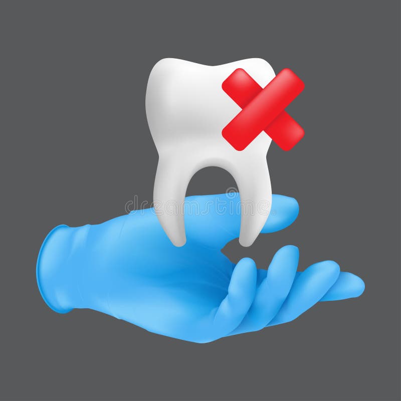 Dentist hand wearing blue protective surgical glove holding a ceramic model of the tooth. 3d realistic vector illustration of teeth extraction concept isolated on a grey background. Dentist hand wearing blue protective surgical glove holding a ceramic model of the tooth. 3d realistic vector illustration of teeth extraction concept isolated on a grey background
