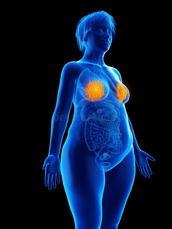 Borstklieren van een obese vrouw royalty-vrije illustratie