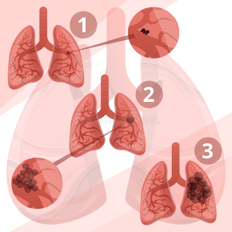 E illustrazione vettoriale E illustrazione vettoriale