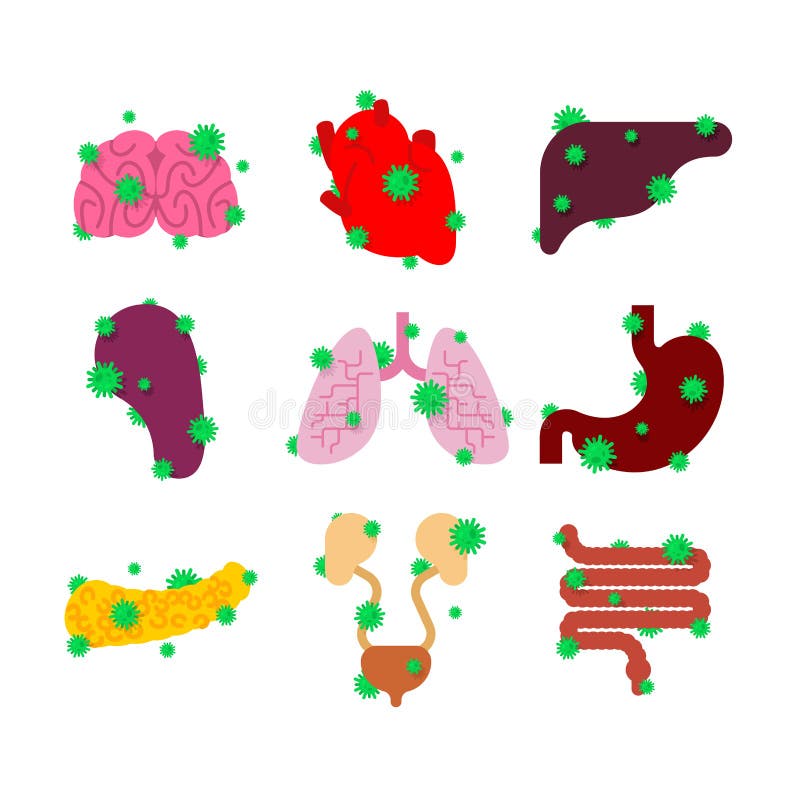 E Cuore e cervello malati r illustrazione vettoriale E Cuore e cervello malati r illustrazione vettoriale