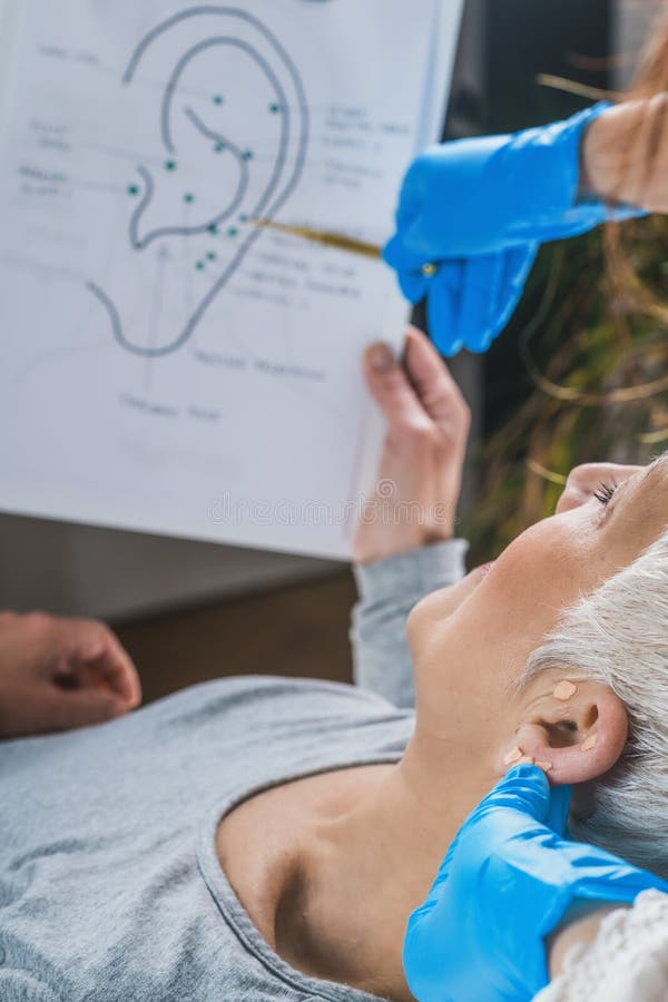 Ear Acupuncture Point Therapy Stock Image Image of massage, hand