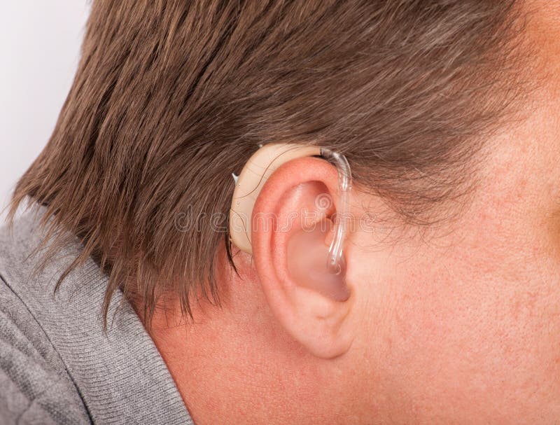 Ear with hearing aid stock image. Image of accessory 75731841