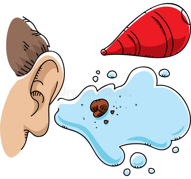 Ear Wax Stock Illustrations – 253 Ear Wax Stock Illustrations, Vectors &  Clipart - Dreamstime