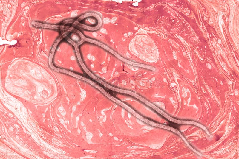 Ebola virus arkivfoton Ebola virus arkivfoton