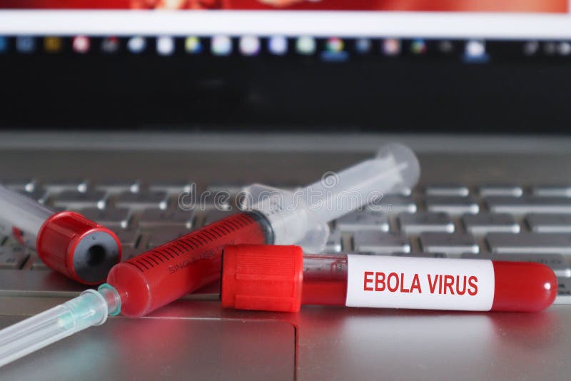 Ebolavirussjukdom EVD är en viral hemorragisk feber hos människor Ebola är en sällsynt och dödlig sjukdom som först upptäcktes 19 royaltyfria bilder Ebolavirussjukdom EVD är en viral hemorragisk feber hos människor Ebola är en sällsynt och dödlig sjukdom som först upptäcktes 19 royaltyfria bilder