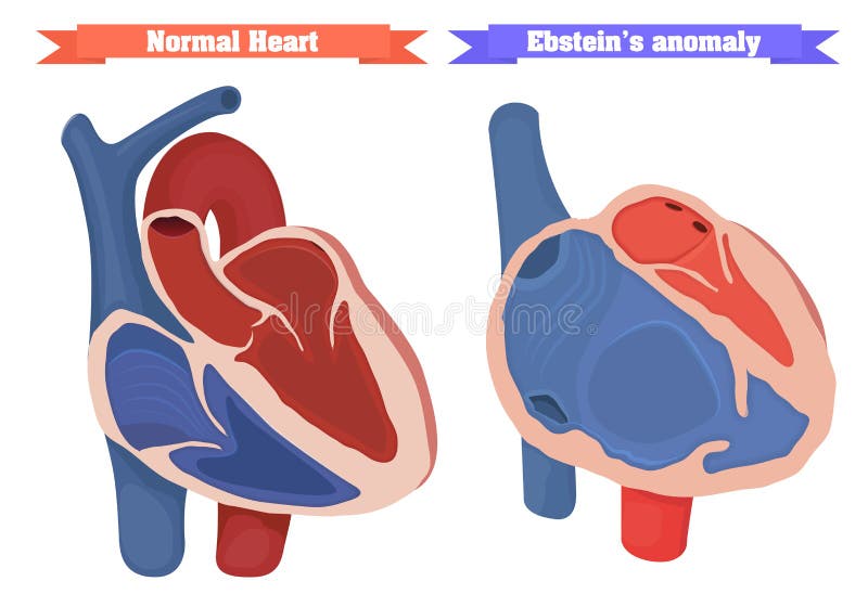 Anomaly Stock Illustrations – 5,785 Anomaly Stock Illustrations, Vectors &  Clipart - Dreamstime