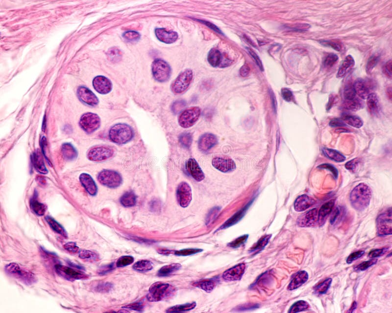 Eccrine Sweat Gland Excretory Duct Stock Image Image Of Dermis