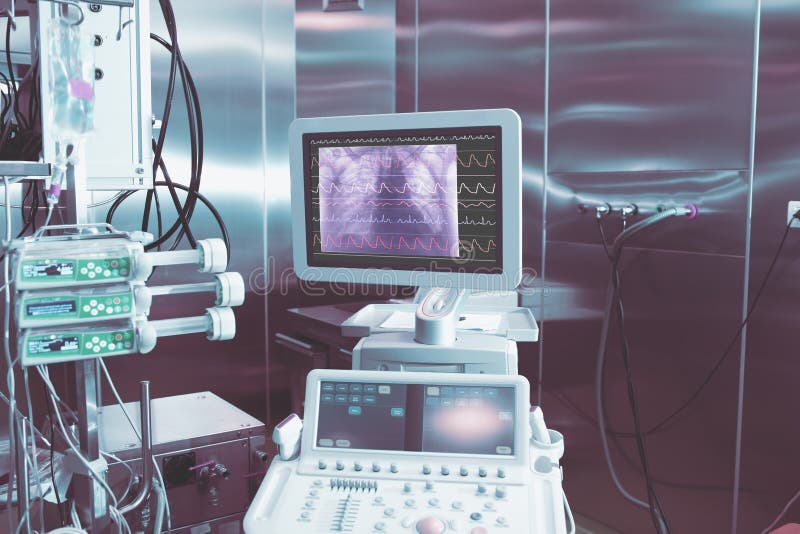 ECG and Chest Xray Image on the Display of Medical Computer in Stock