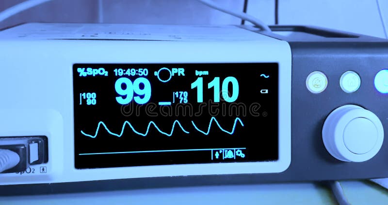 Ecg del electrocardiograma en la sala de urgencias de funcionamiento de la cirugía del hospital que muestra el ritmo cardíaco pac