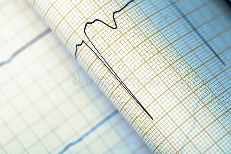 ECG graph, medical textured background