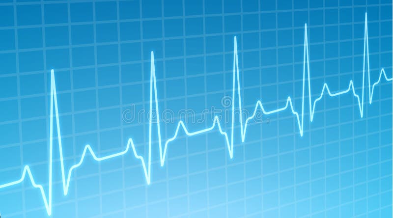 Wegversperring Hobart Bisschop ECG Hartslagmonitor, Cardiogram Hartpullgolf Medische Achtergrond  Elektrocardiogram Vector Illustratie - Illustration of gezond, meter:  167523619